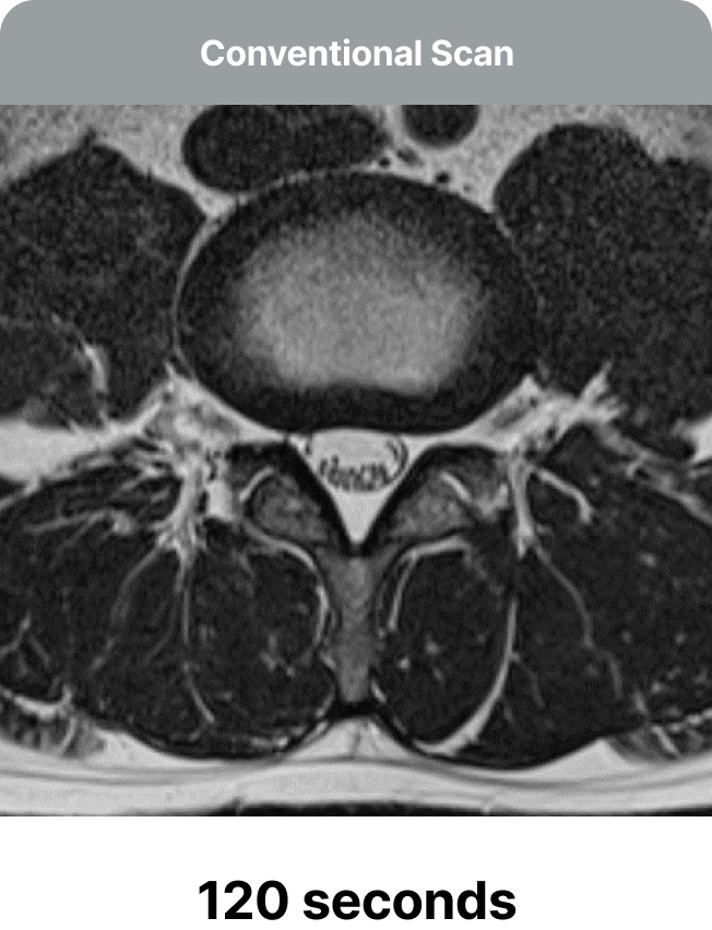 Protocol Optimization